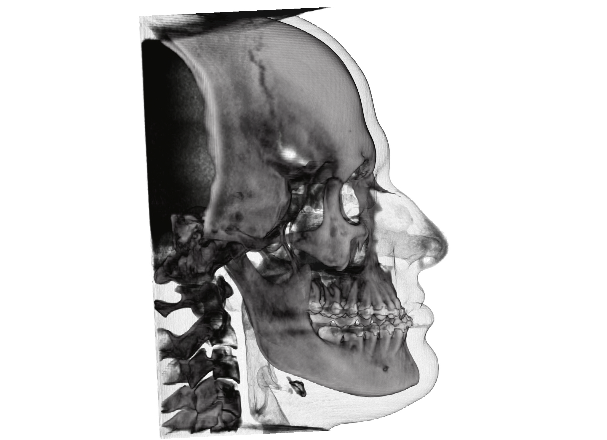 Cirurgia Ortognática - Otávio Ferraz